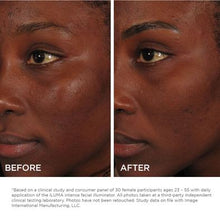 Load image into Gallery viewer, Iluma Intense Facial Illuminator

