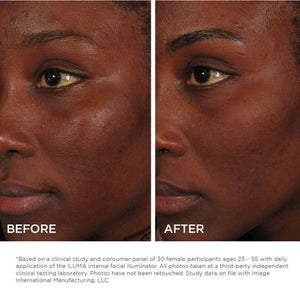 Iluma Intense Facial Illuminator